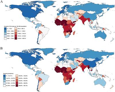 Global burden of anemia and cause among children under five years 1990–2019: findings from the global burden of disease study 2019